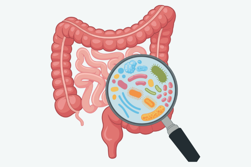 MICI (Maladie de Crohn, RCH) : comprendre les causes, symptômes, complications et traitements