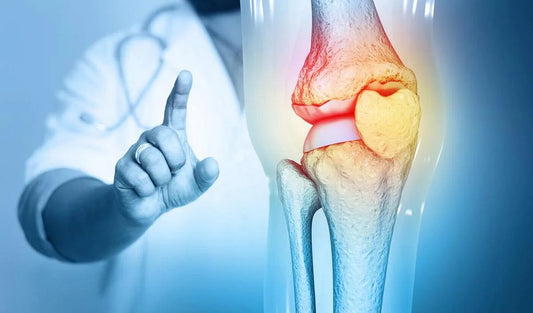 Arthrose : soulager naturellement cette maladie articulaire