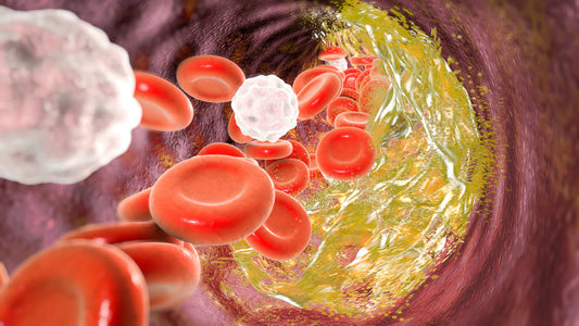 Maintenir sa cholestérolémie : comment faire ?