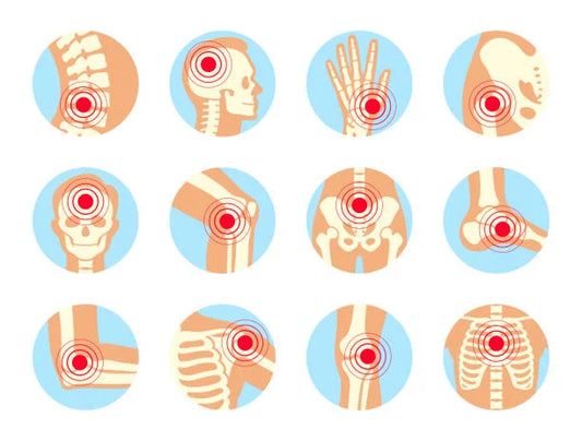 Qu’est-ce que l’arthrite ?